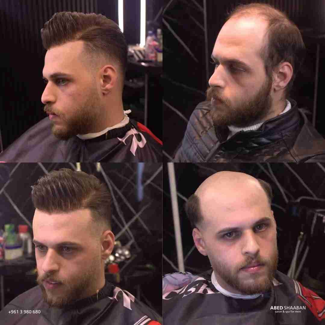 Client hair topper transformation Beirut