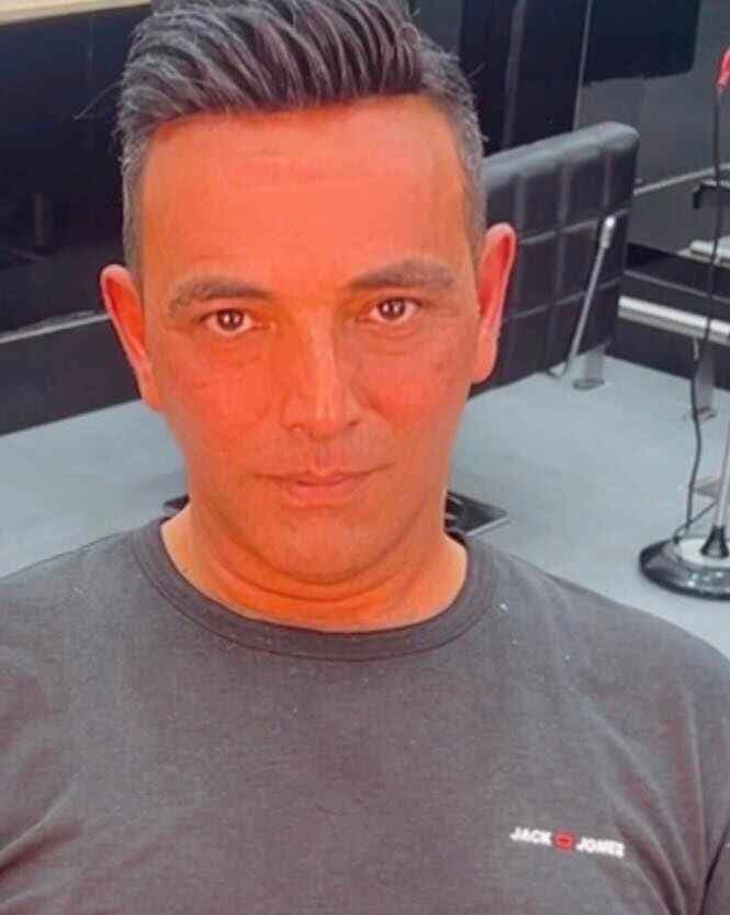 Client 3 hair topper transformation Beirut